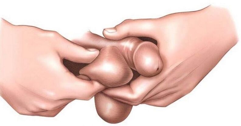 Why itchy eggs on men
